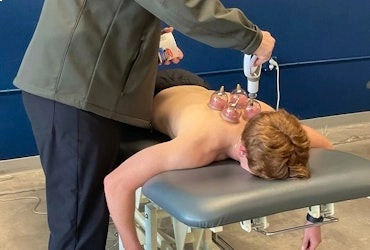 Physical therapist providing cupping therapy to a patient lying face down on a treatment table