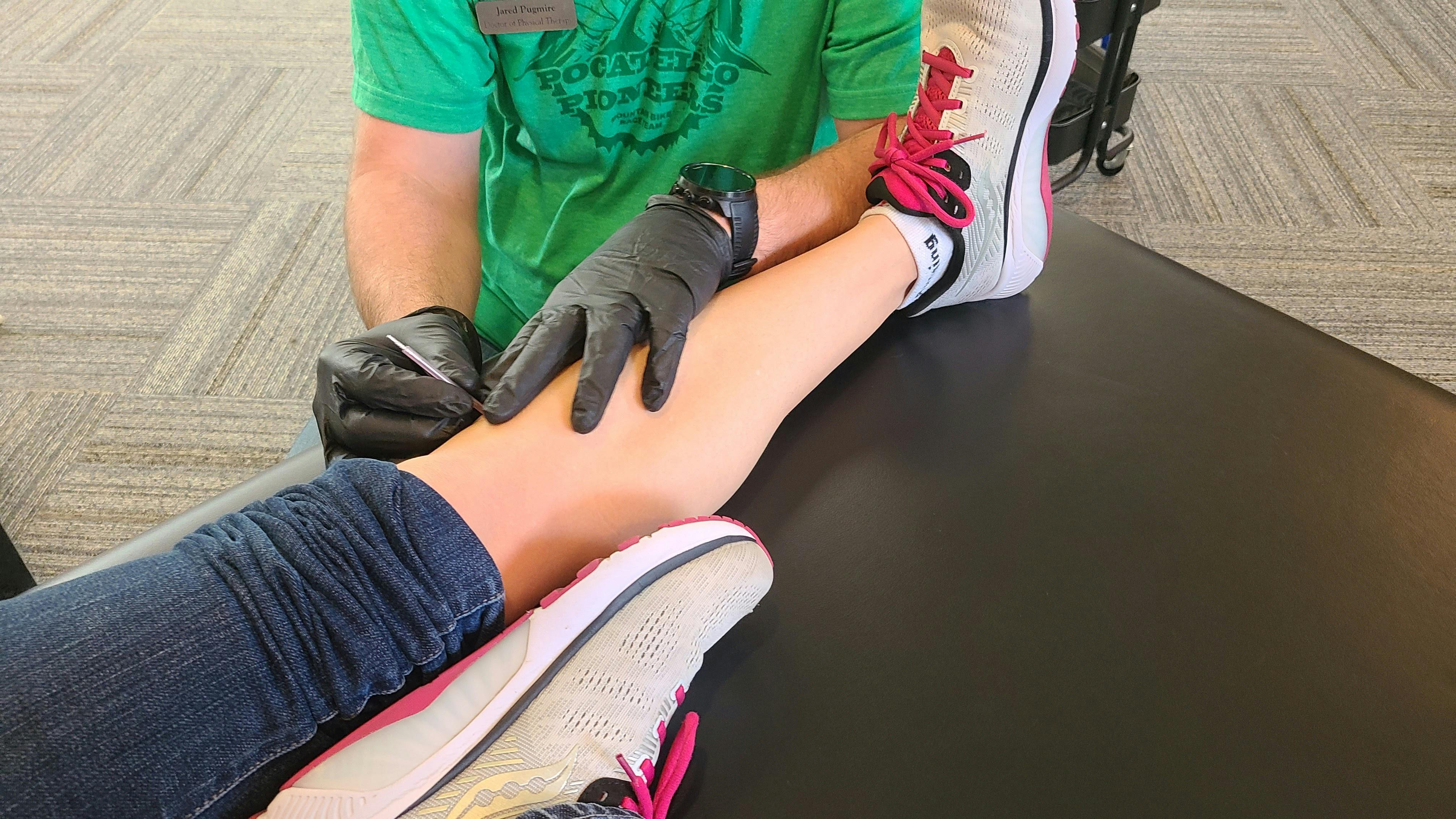 A physical therapist wearing gloves performing dry needling on a patient's calf