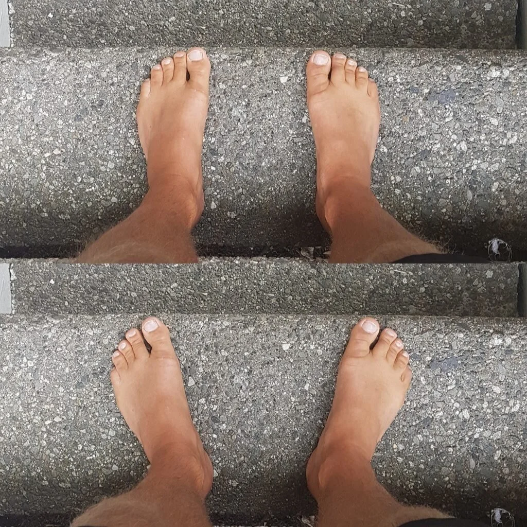 split image of good foot position when standing and rotated foot position when standing