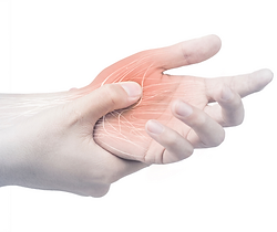 Hand pain illustration