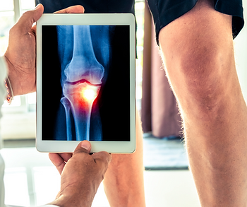 Knee pain illustration