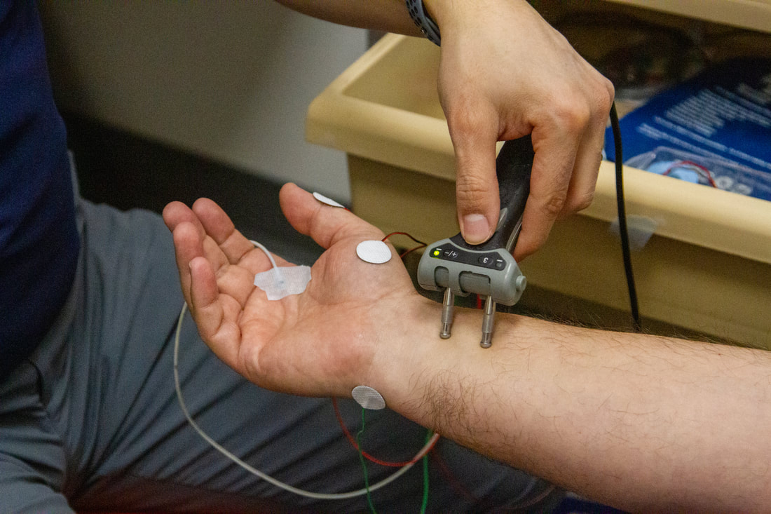 Electrodes placed on a patient’s forearm for nerve testing
