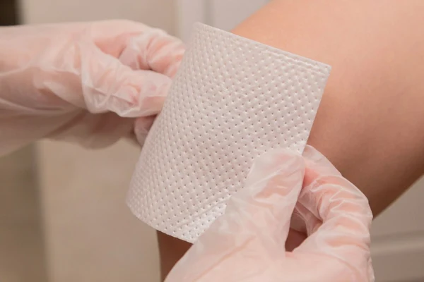 Wound care services